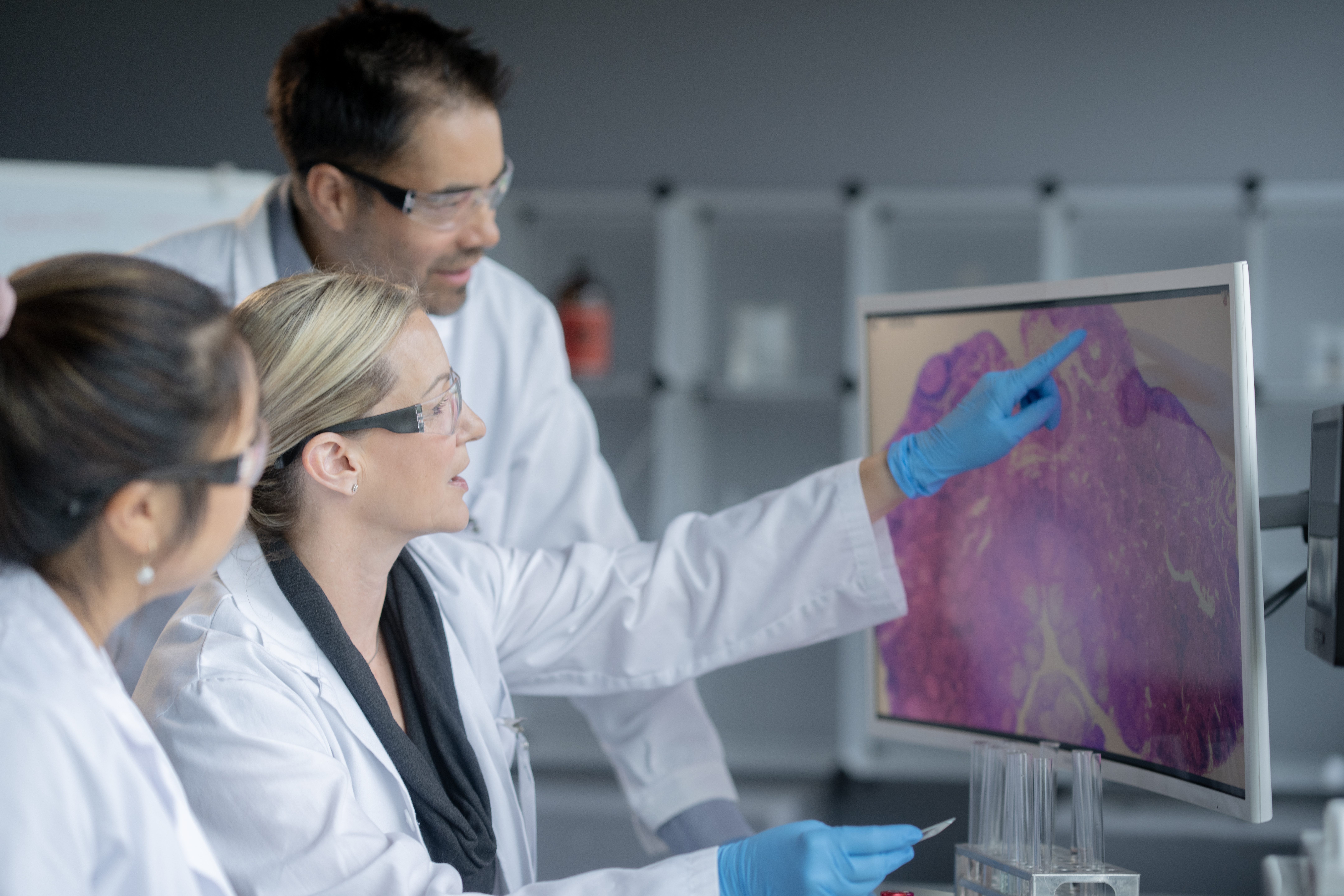 5 ways to unlock to potential of digital pathology in clinical trials